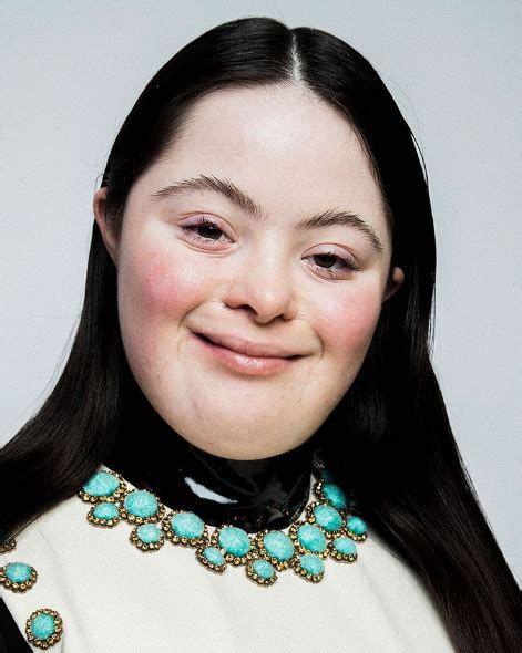 gucci modella sindrome di down|gucci down syndrome commercial.